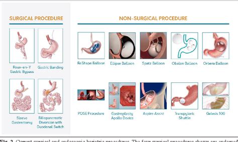 Perioperative nutrition support .